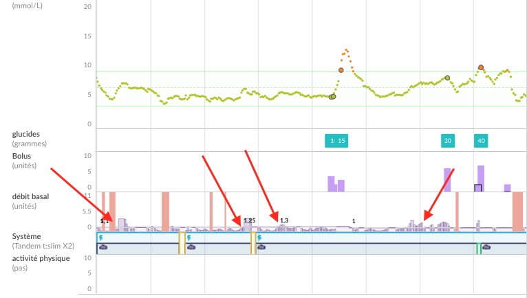 french-web-onedaycontrolIQ-peaks.png